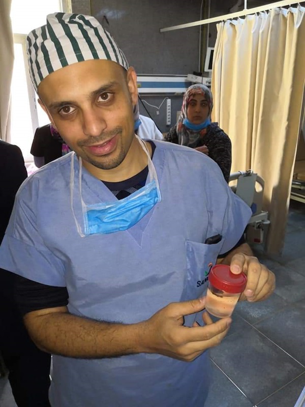 استئصال جزء من الفص السفلى للرئة بالتخدير الموضعى بمستشفى بنها الجامعى 