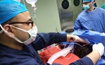 استئصال ورم سرطانى خطير من معدة سيدة بالتأمين الصحي ببنها