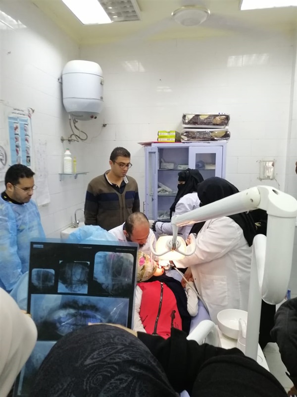 بالصور.. فريق طبي ينجح في استئصال "ناب مطمور" لفتاة بعيادة الأسنان بإدارة بيلا الصحية