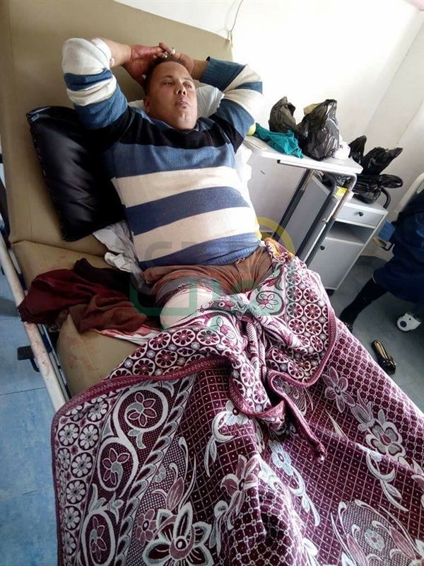 بالصور.. إصابة خفيرين من مركز شرطة بيلا بكفر الشيخ على يد مجهولين