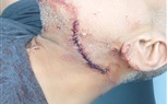 باستخدام كلبه.. ضبط تاجر مخدرات لشروعه فى قتل موظف ونجله بالمعصرة