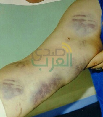 بالصور.. ضبط المتهمين بالتعدي على بائعة سجائر