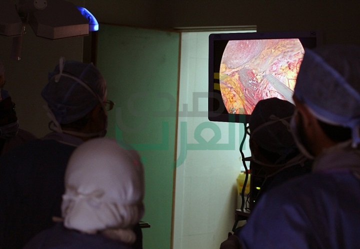 خبير عالمي يجري جراحات أورام للكلى بالمجان بمستشفى جامعة قناة السويس