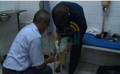 أطراف صناعية للسجناء المصابين بإعاقة جسدية