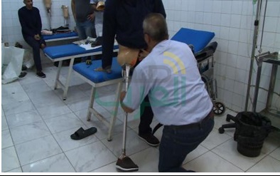أطراف صناعية للسجناء المصابين بإعاقة جسدية