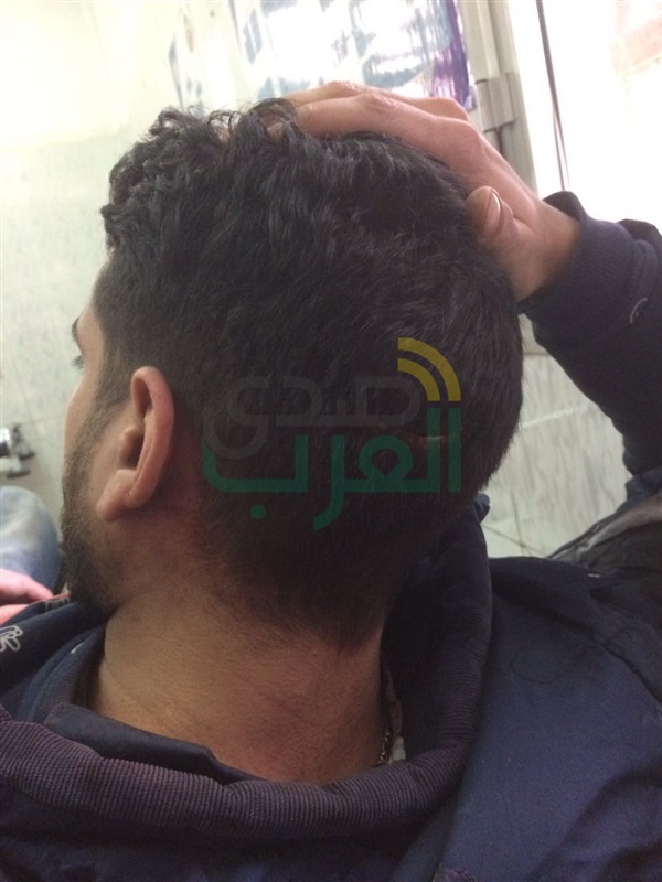 بالصور.. التفاصيل الكاملة لمشاجرة «جنينه» وأسرته فى التجمع الأول