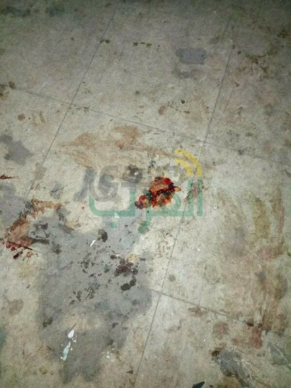 ننشر صور حادث سقوط اسانسير بمستشفى بنها الجامعى 