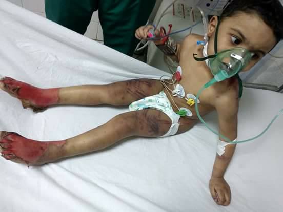 بالصور.. التفاصيل الكاملة لتعذيب طفل علي يد والدته بكفر الشيخ