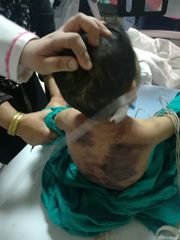 بالصور.. التفاصيل الكاملة لتعذيب طفل علي يد والدته بكفر الشيخ