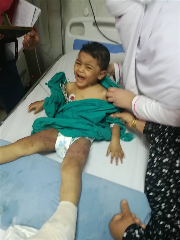 بالصور.. التفاصيل الكاملة لتعذيب طفل علي يد والدته بكفر الشيخ
