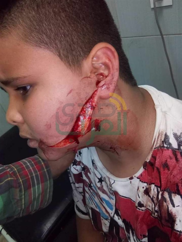 بالصور: بلطجية يقتحمون مدرسة ابتدائى بالهرم ويعتدون على طالب بالسنجة فى وجهه