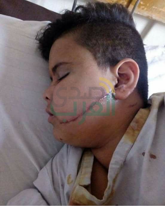 بالصور: بلطجية يقتحمون مدرسة ابتدائى بالهرم ويعتدون على طالب بالسنجة فى وجهه