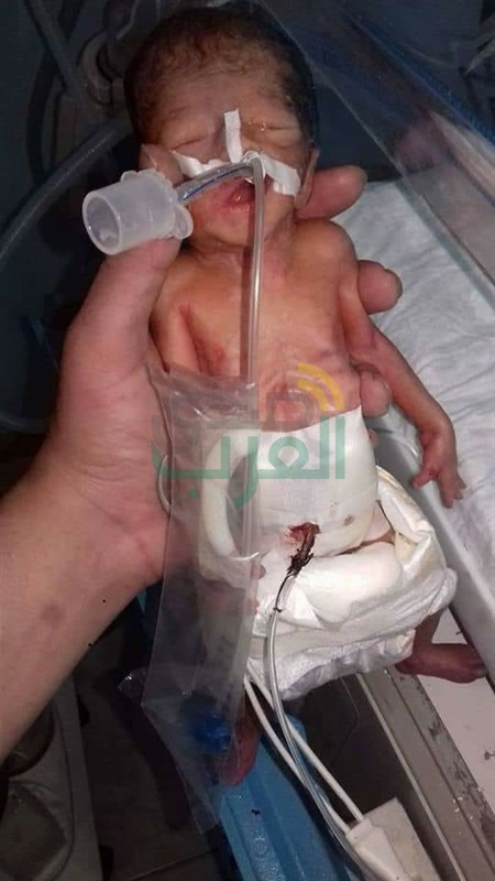 غلق مركز حضانات شهير بـ"بنها" بعد ظهور حشرات داخله 
