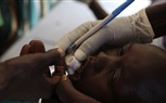 السودان تدق جرس إنذار استعدادا لوبائيات الكوليرا والملاريا والحمى النزفية