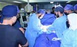 طب سوهاج تنظم ورشة متخصصة في جراحات الكبد والبنكرياس وتجري عدد من العمليات الجراحية الدقيقة