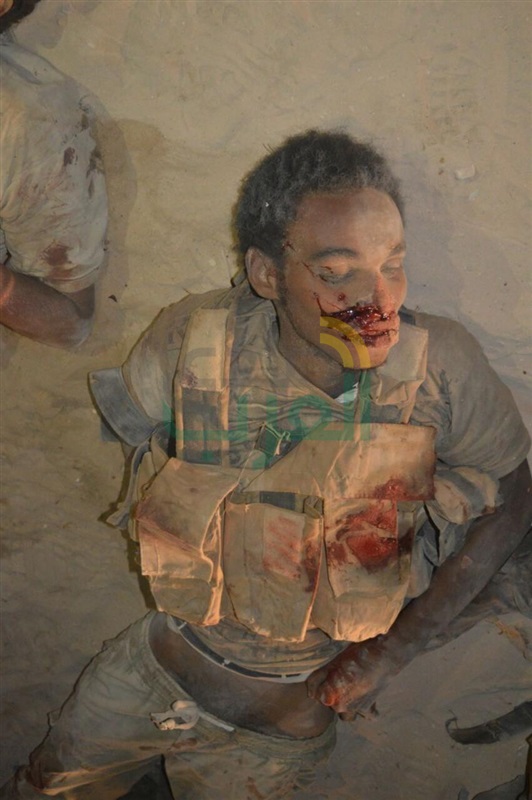 شاهد.. صور جثث العناصر الإرهابية المهاجمة لنقاط تأمين منطقة القواديس