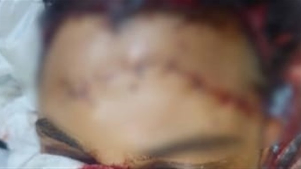 واقعة التعدي
